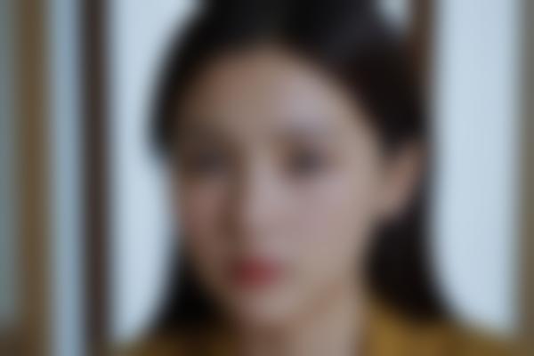 曲胜医生擅长项目解析