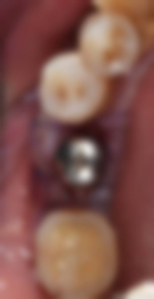 湖南衡阳耒阳诺贝尔口腔的患者口碑