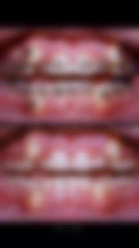 黄忠祥的临床实战与真实实例