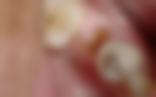 烟台泰麟口腔门诊部的正规资质