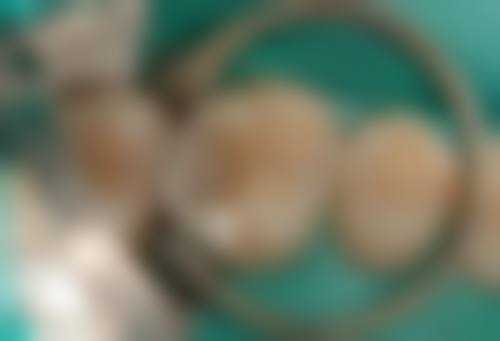 惠州至上德口腔技术优势