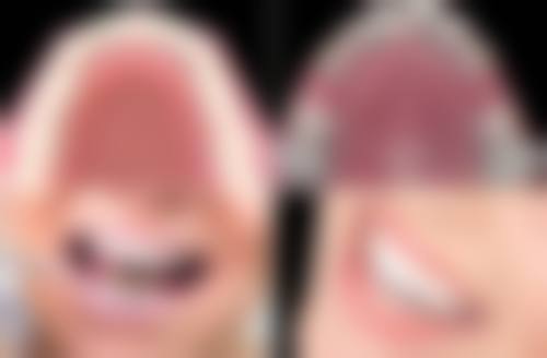 深圳微齿口腔诊所患者口碑