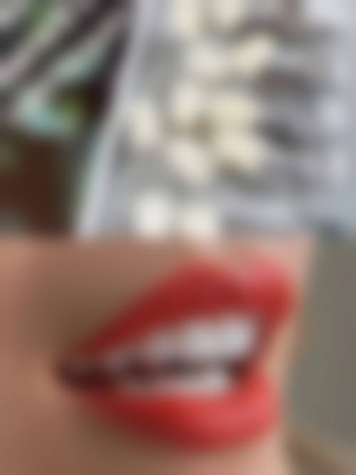 昆明华美美莱口腔科价格收费