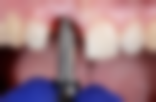 吴晓增的临床实战与真实实例