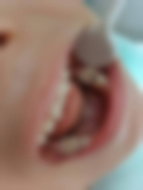 南京江北蓝鲟口腔价格收费