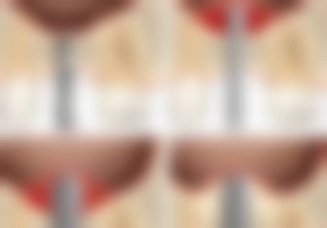 深圳博瑞尔口腔诊所价格收费