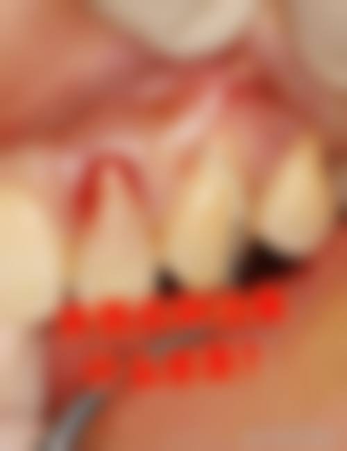 海口鼎点口腔诊所患者口碑