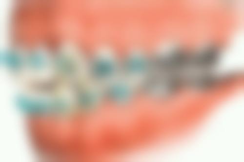 王正明的临床实战与真实实例