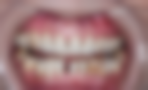 曹雨庵的价格与坐诊