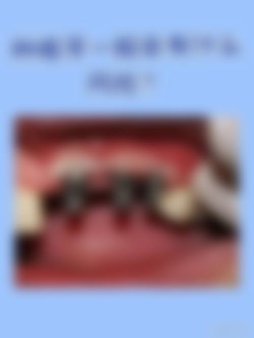 河北德尔灵寿口腔诊所价格收费