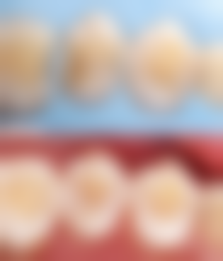 杜小平的临床实战与真实实例