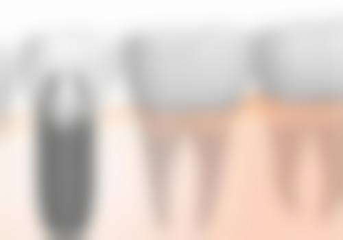 高密菲达口腔医生团队