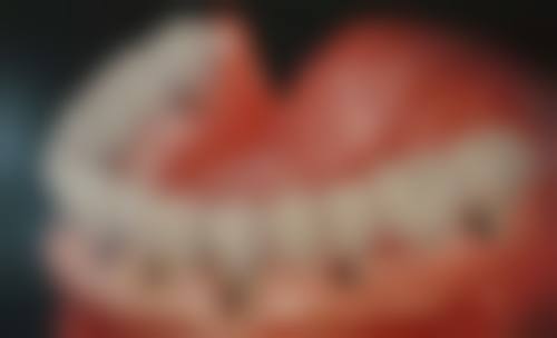 高密菲达口腔来院路线