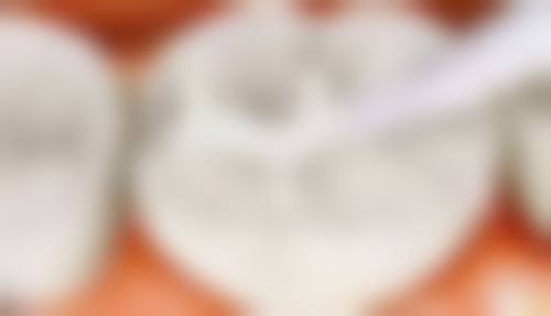 青海省妇女儿童医院口腔科价格收费