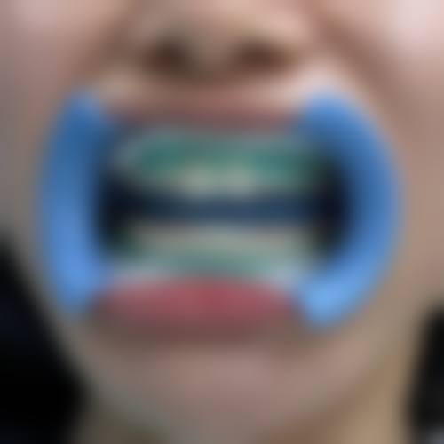 达州华美口腔医院技术优势