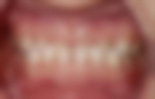 达州华美口腔医院患者口碑