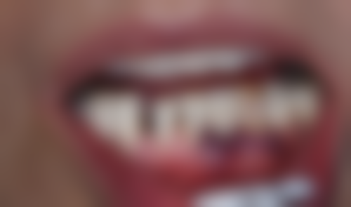 浙江温州龙湾江学青口腔正规资质