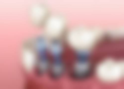 六枝柯品牙管家口腔门诊部价格收费