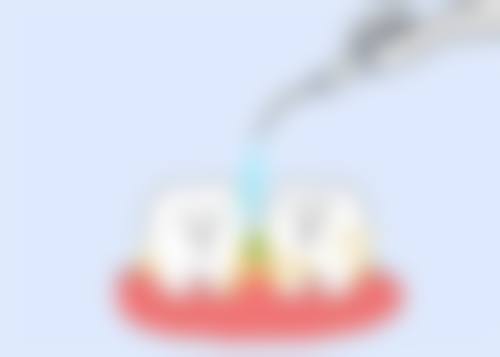 台州三门季全口腔诊所技术优势