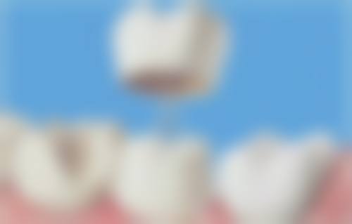 宁波好牙引领口腔的技术优势