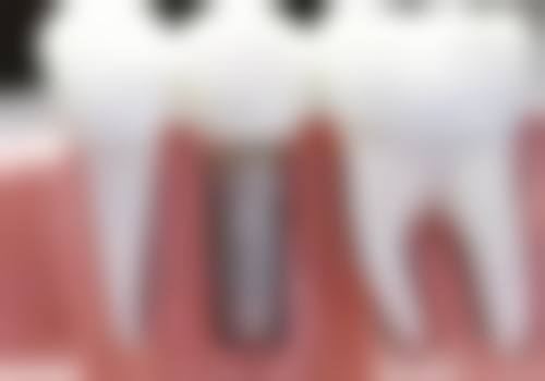 昭通德韩口腔医院特色技术