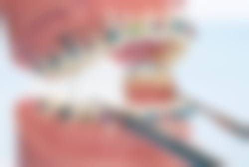 陈宪勇的临床实战与真实实例