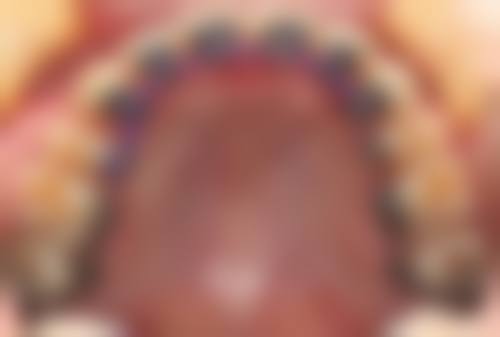 陈宪勇的诊疗标准与服务细节