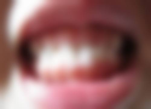 石秋雨的临床实战与真实实例