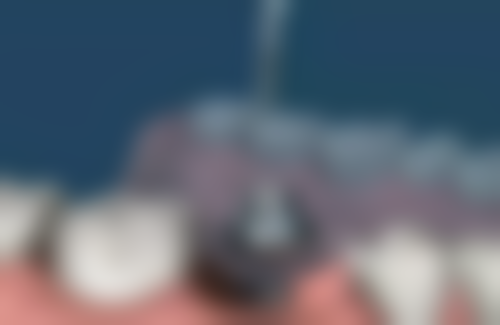 宁海牙贝恩口腔（西子店）的来院路线