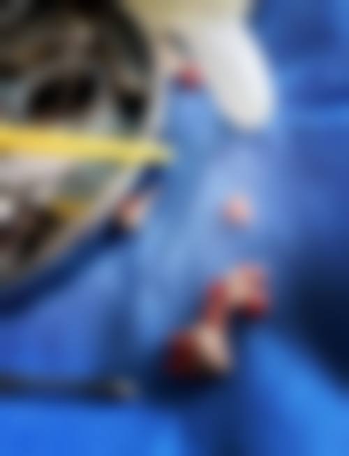 石秋雨的临床实战与真实实例