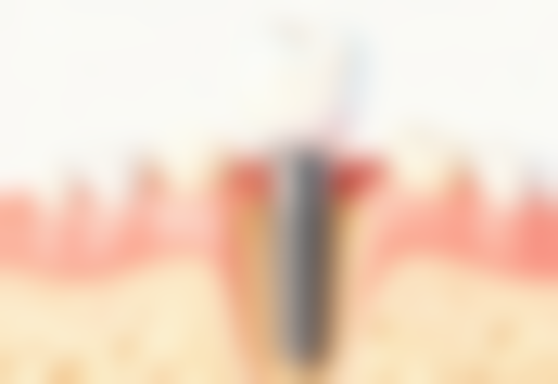 湖南株洲博尔口腔价格收费