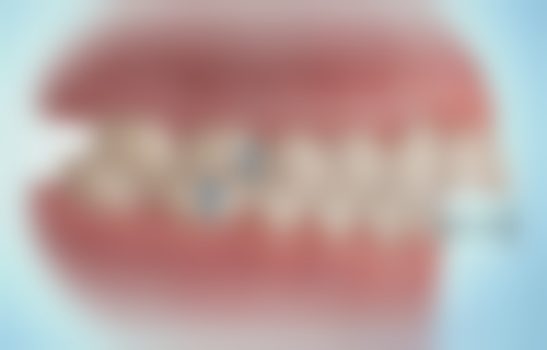 阿拉尔陈爱民口腔诊所正规资质