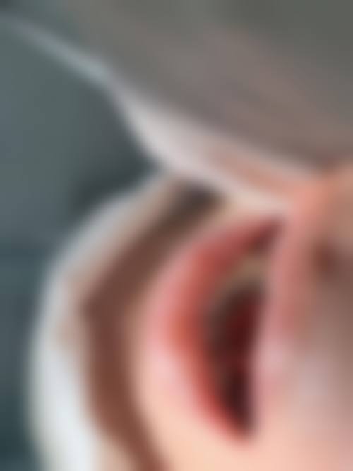 陶芬的临床实战与真实实例