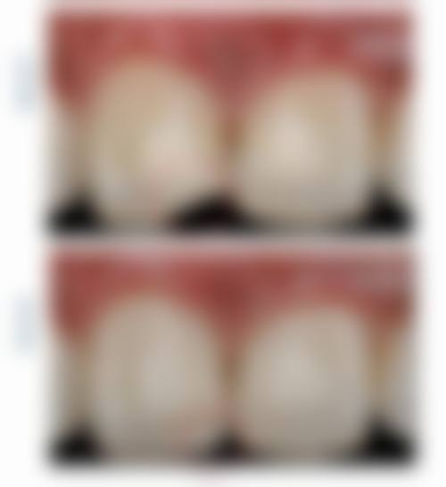 廊坊三河双诚皓齿口腔价格收费