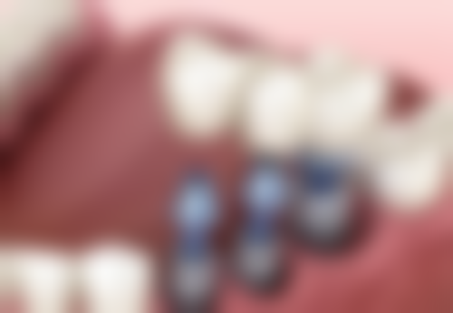 陶芬的临床实战与真实实例