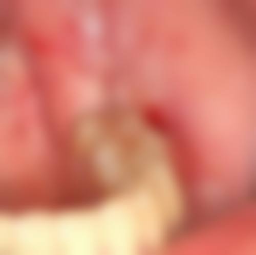 西藏拉萨雅博仕口腔(林芝店)价格收费