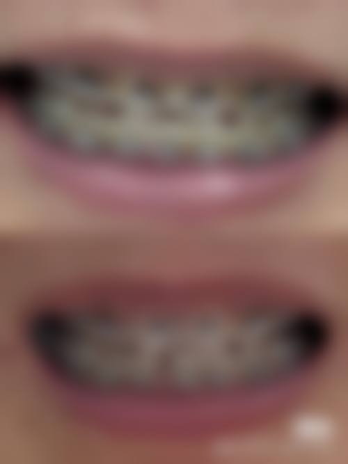 乌鲁木齐胡金玲口腔诊所技术优势