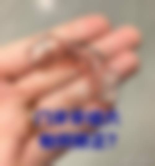 太仓徐美亚口腔的患者口碑