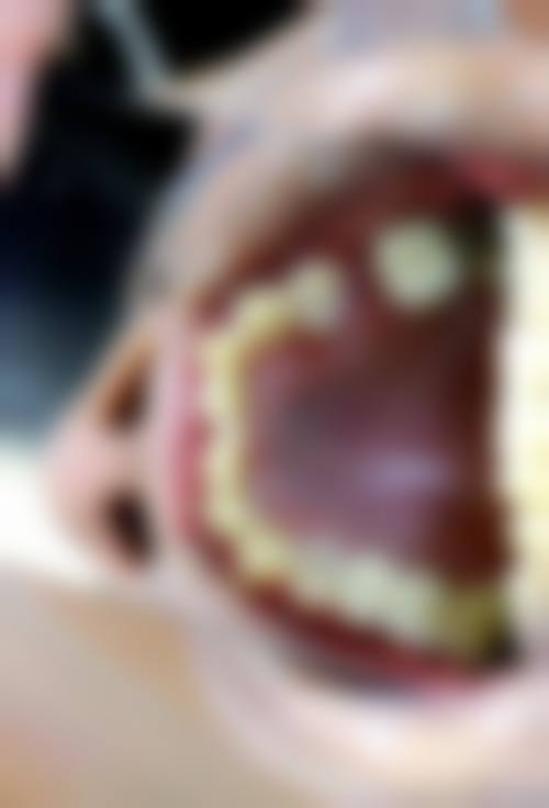 张家口市第四 医院口腔科的来院路线