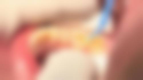 何琴的临床实战与个性化方案制定