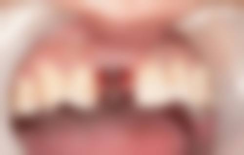 山东德州宁津康尔乐口腔的价格收费