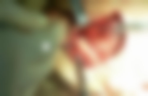 呼伦贝尔市人民医院口腔颌面外科患者真实评价