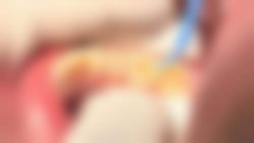 王毅军的临床实战与个性化诊疗