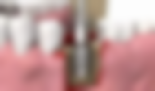 何琴的诊疗标准与服务细节