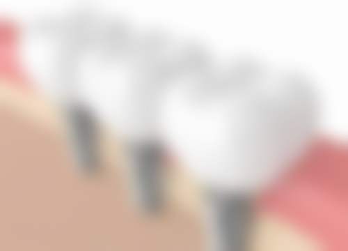 福建泉州柏德口腔收费价格参考