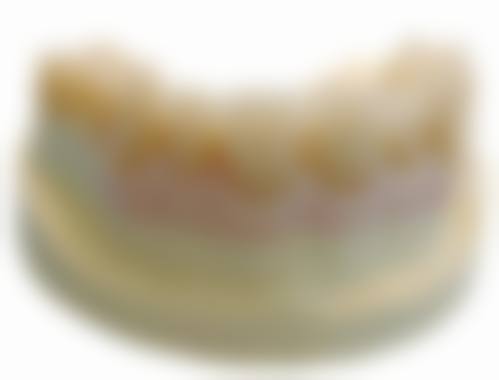 杭州协佳口腔(三墩诊所)透明收费标准