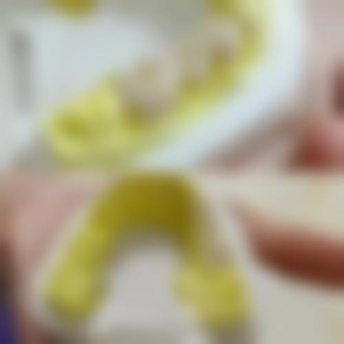 张可娟的临床实战与个性化方案制定