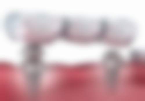 广州维雅口腔就诊预约与来院指引