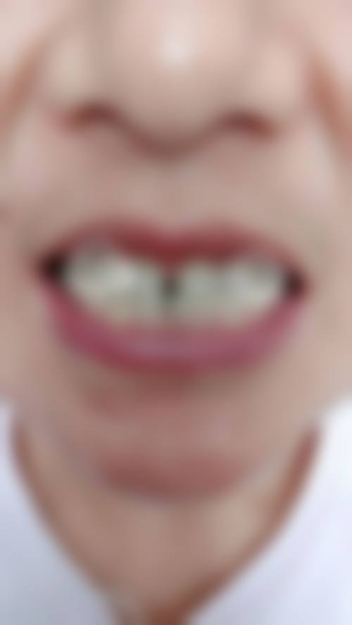 樊熊越的诊疗标准与服务细节