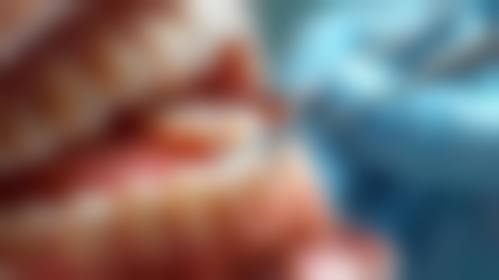 杭州开乐口腔诊所透明收费标准